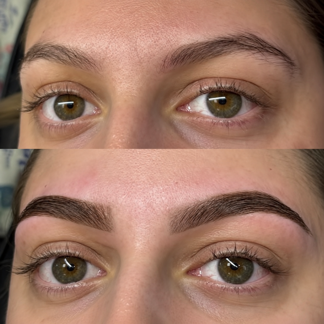Treatment result