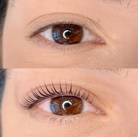 Treatment result