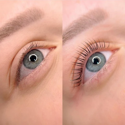 Treatment result